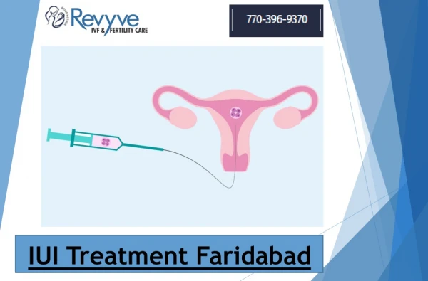 IUI Treatment Faridabad