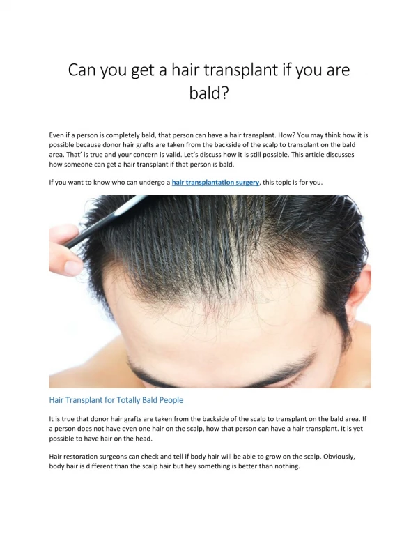 Can you get a hair transplant if you are bald?