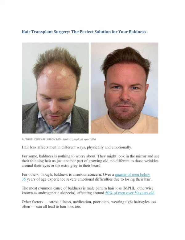 Hair Transplant Surgery: The Perfect Solution for Your Baldness