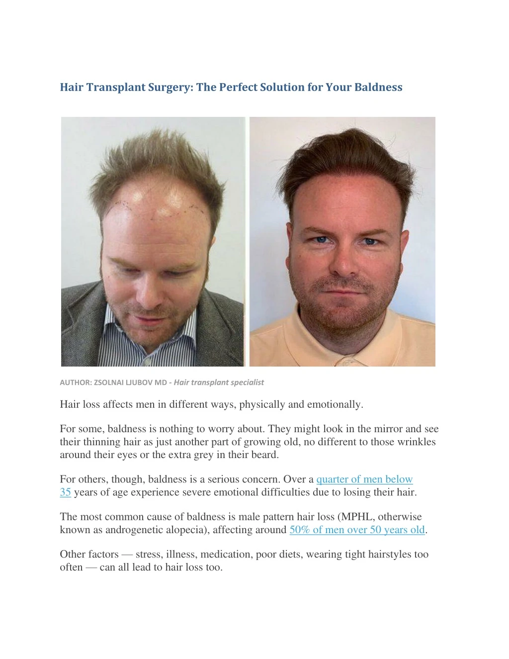 hair transplant surgery the perfect solution