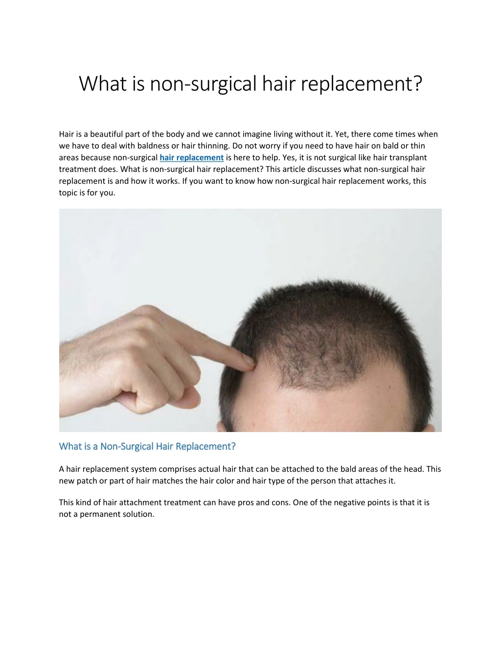 what is non surgical hair replacement