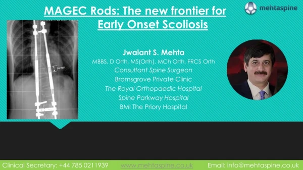 Magec rods the new frontier for early onset scoliosis