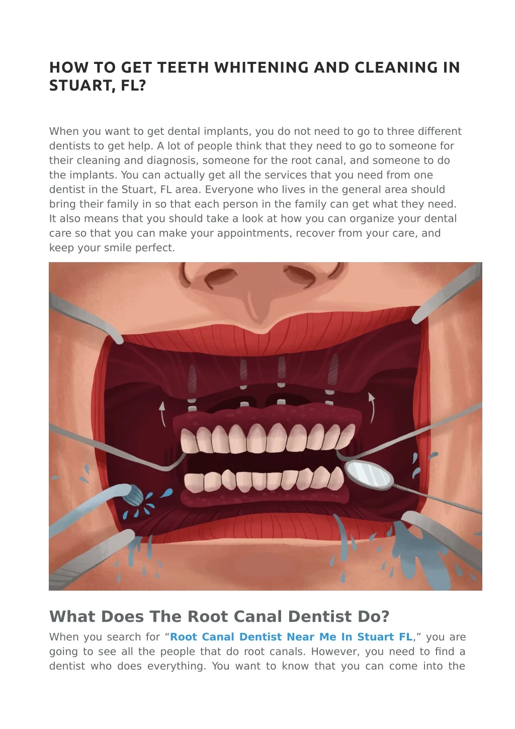 how to get teeth whitening and cleaning in stuart