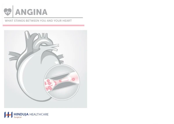 Angina - What stands between you and your heart