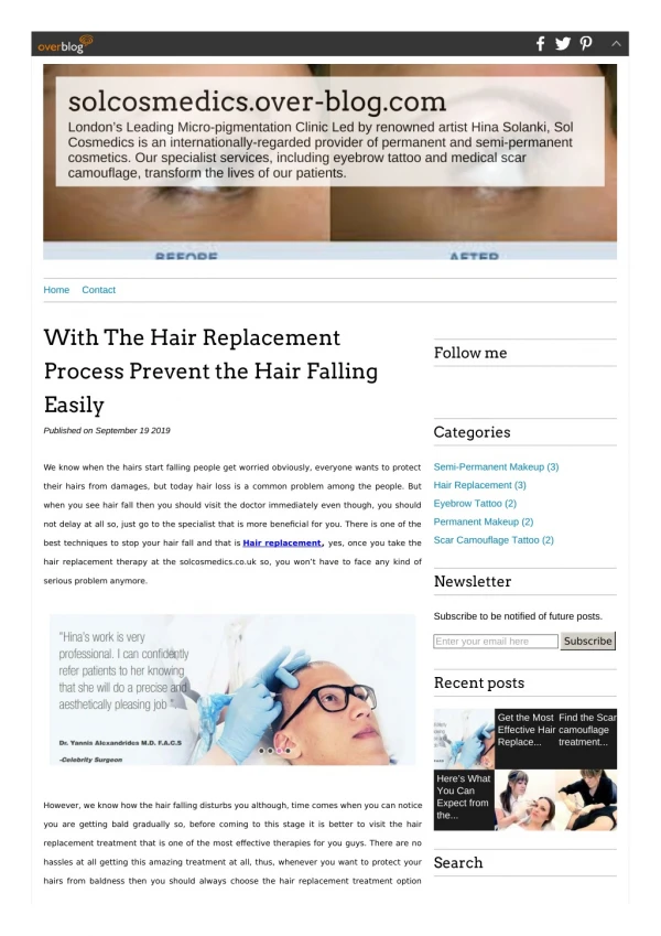 Prevent Hair Falling Easily With Hair Replacement Process