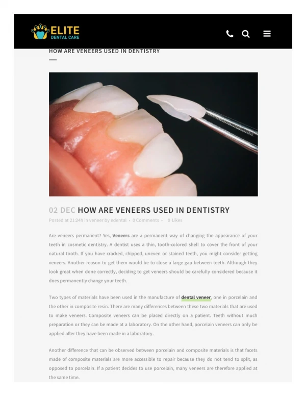 How are Veneers Used in Dentistry - Elite Dental Care Tracy