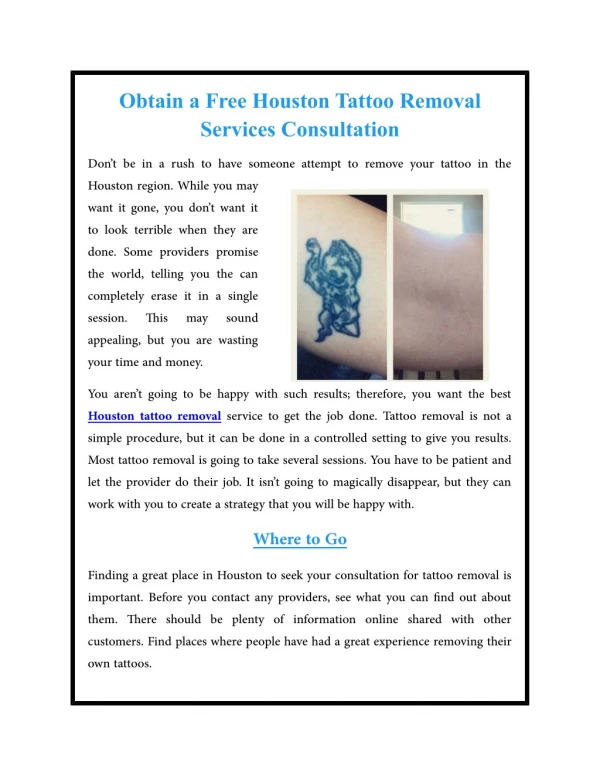 Obtain a Free Houston Tattoo Removal Services Consultation