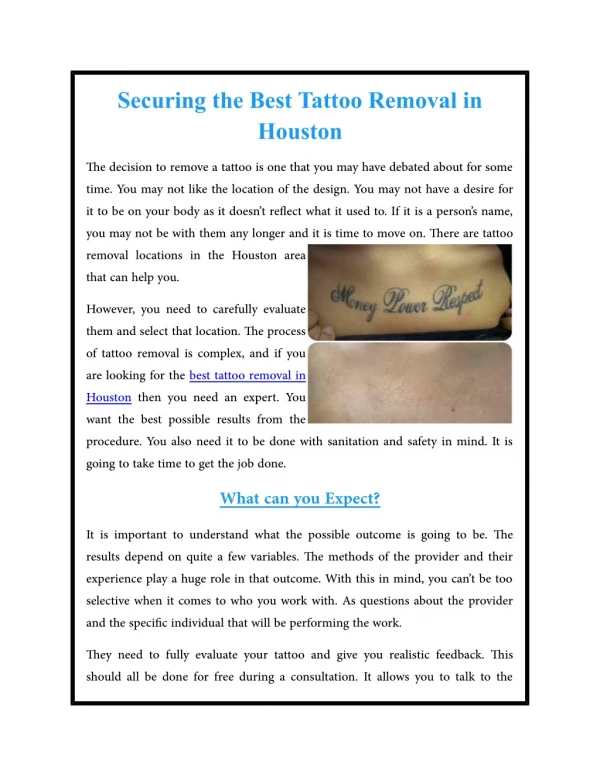 Securing the Best Tattoo Removal in Houston