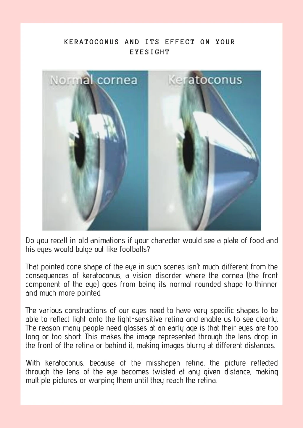 keratoconus and its effect on your eyesight