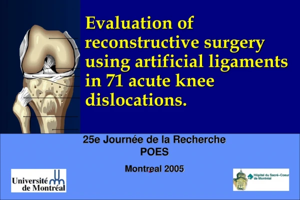 Evaluation of reconstructive surgery using artificial ligaments in 7 1 acute knee dislocations.