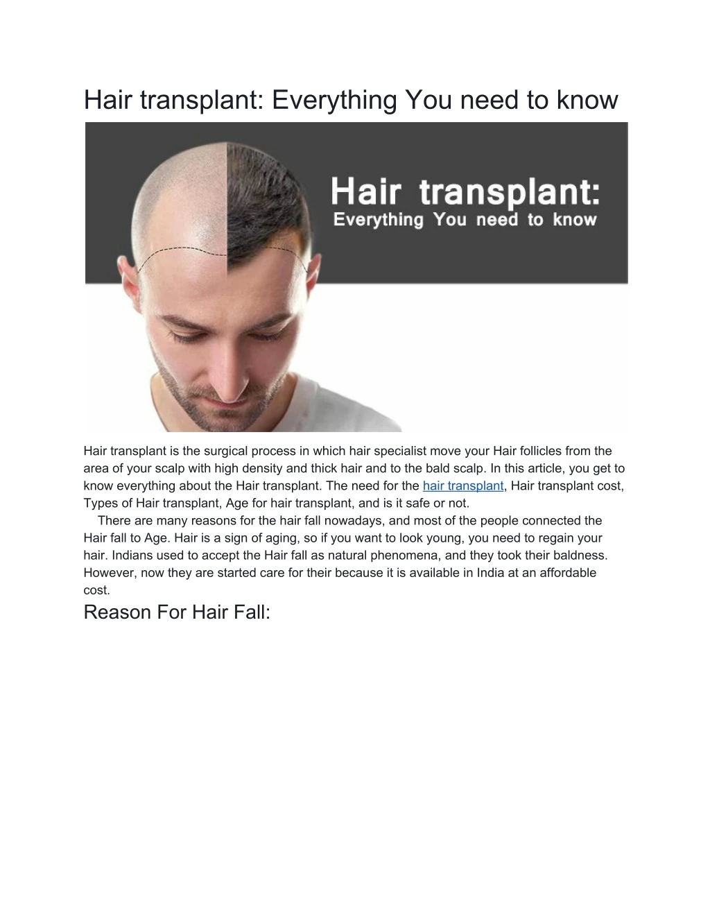 hair transplant everything you need to know