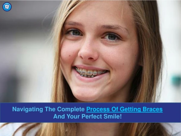 Process Of Getting Braces | Orthodontic Experts