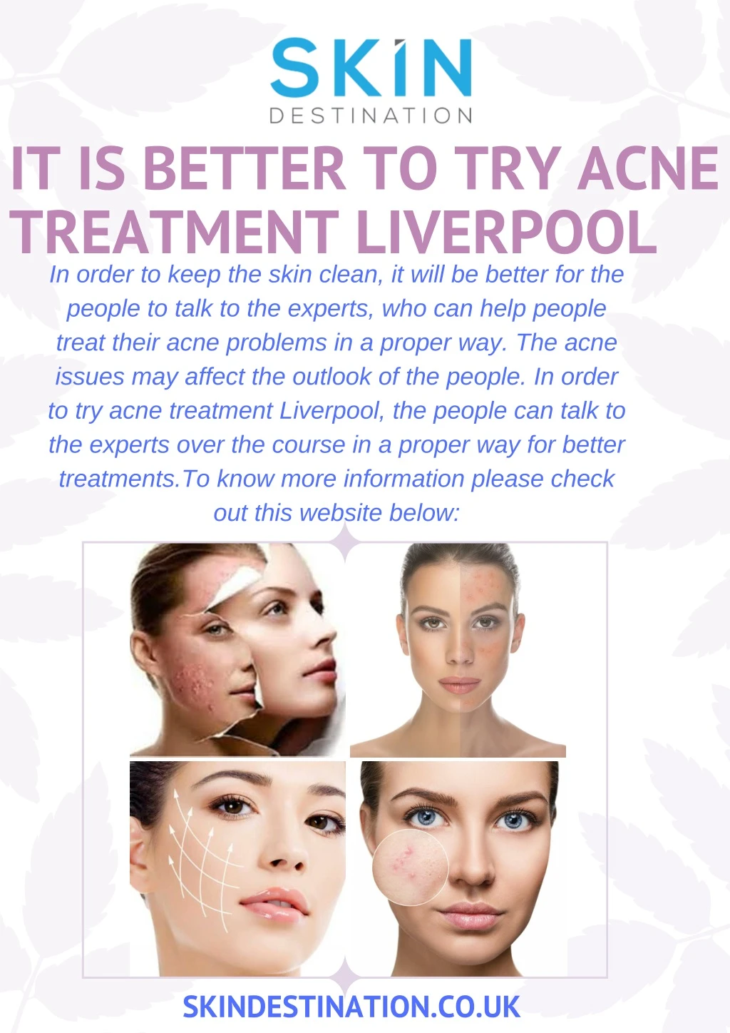 it is better to try acne treatment liverpool