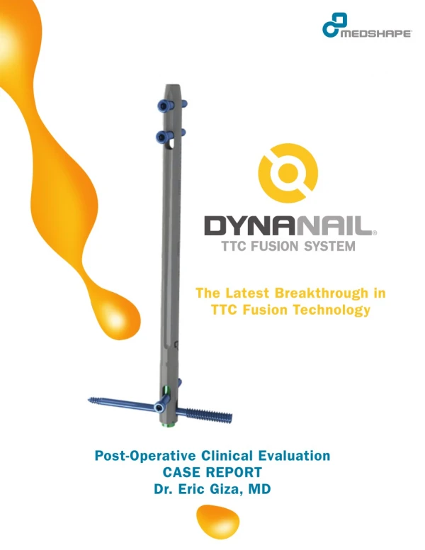 DynaNail® TTC Fusion System - Post-Operative Clinical Evaluation Case Report