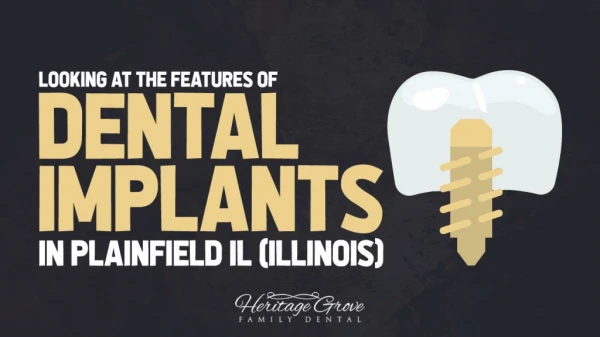 Looking at the Features of Dental Implants in Plainfield IL (Illinois)
