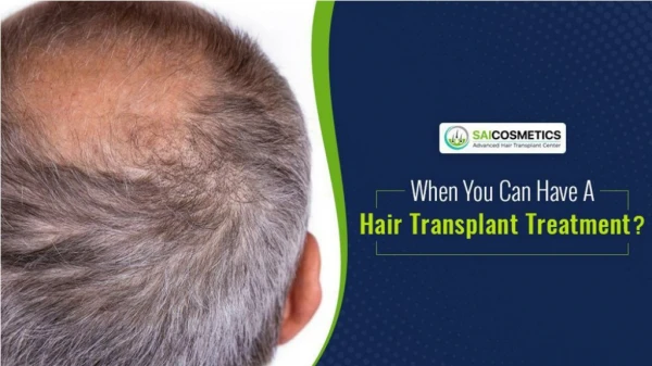 When You Can Have A Hair Transplant Treatment?