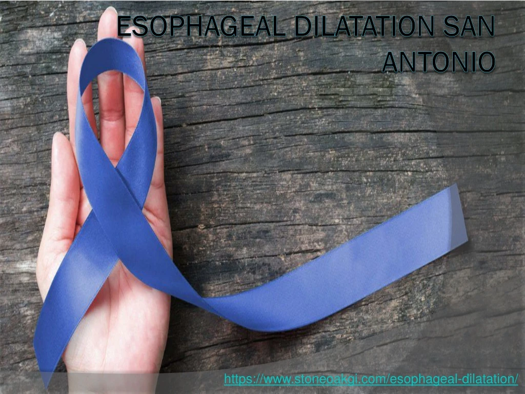 esophageal dilatation san antonio