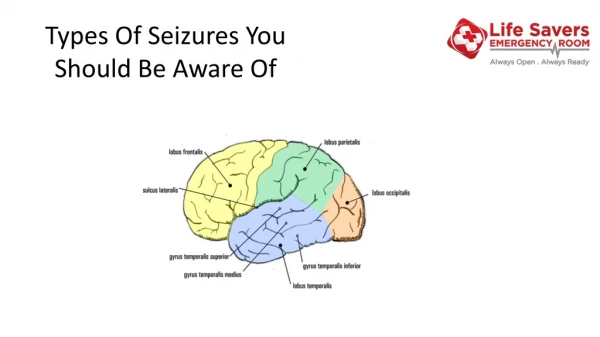 Types Of Seizures You Should Be Aware Of