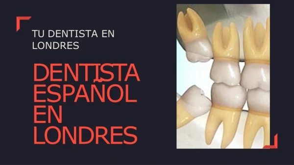 Dentista Español En Londres Para Todo Tipo De Ayuda Dental