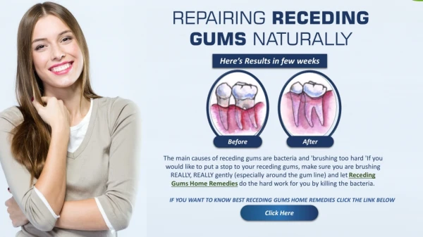 Reverse Gum Recession Naturally