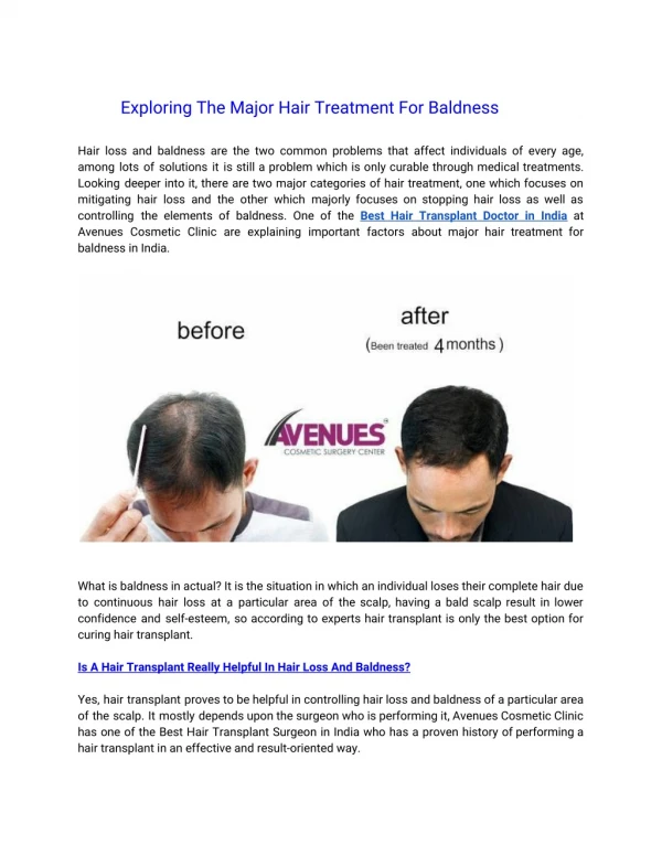 Exploring The Major Hair Treatment Options For Baldness