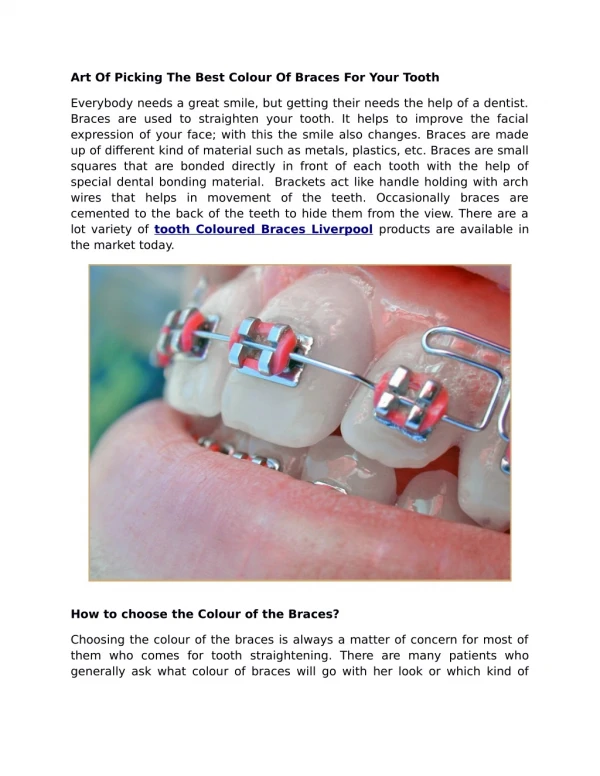 Art Of Picking The Best Colour Of Braces For Your Tooth