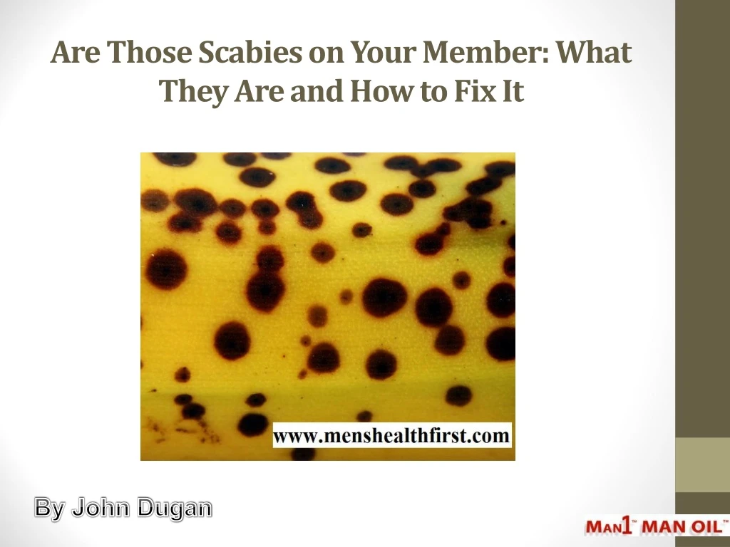 are those scabies on your member what they are and how to fix it