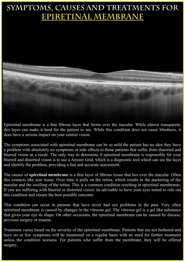 Symptoms,Causes and Treatments for Epiretinal Membrane