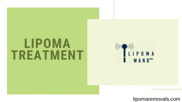 lipoma treatment