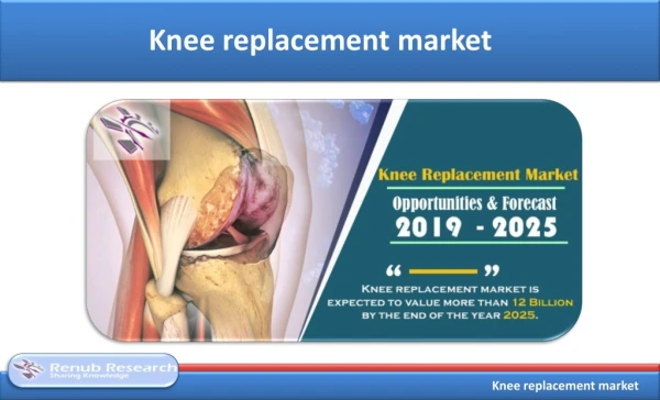 Knee replacement market is 12 Billion by 2025