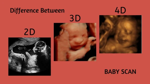 Difference Between 2D, 3D, And 4D Ultrasound Baby Scan
