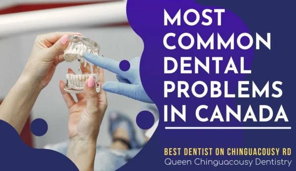 Common Dental Problems in Canada By Best Dentist on Chinguacousy Rd