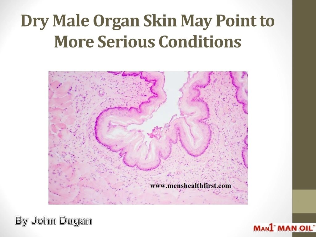 dry male organ skin may point to more serious conditions