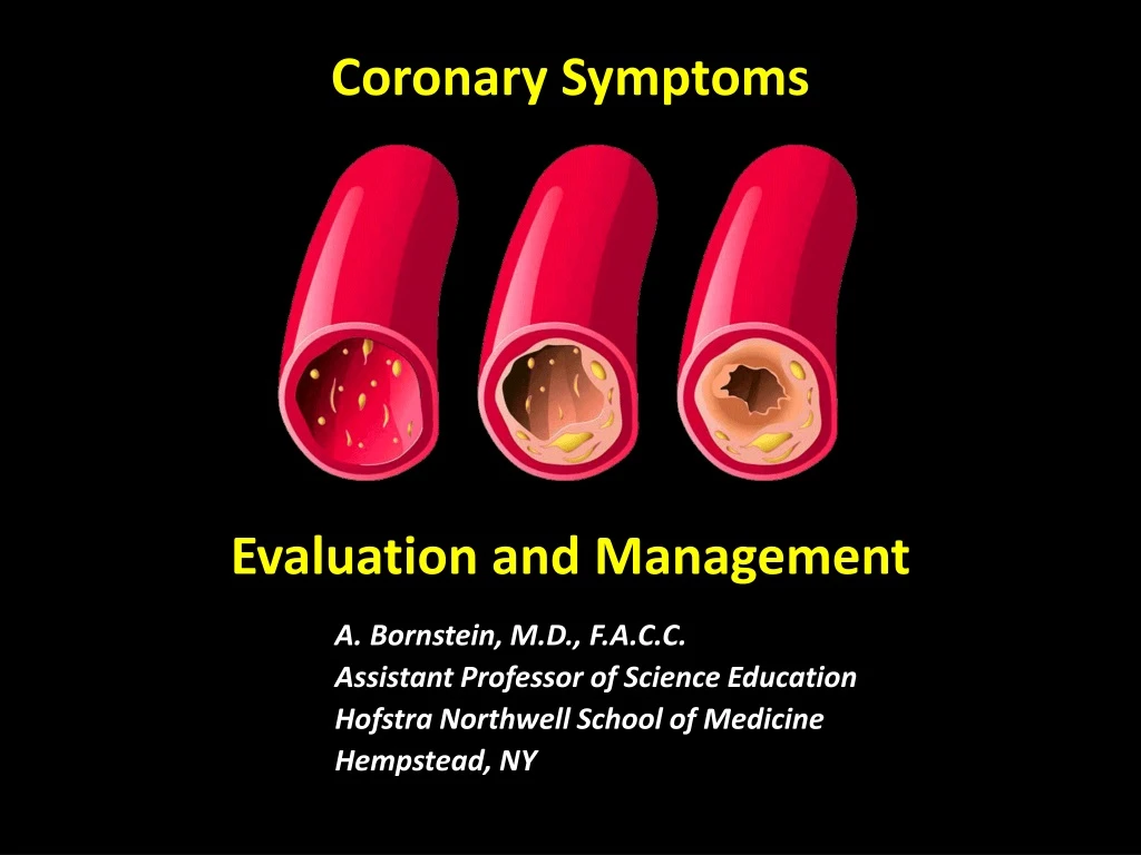 coronary symptoms evaluation and management