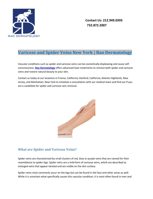 varicose and spider veins New York | Rao Dermatology NY