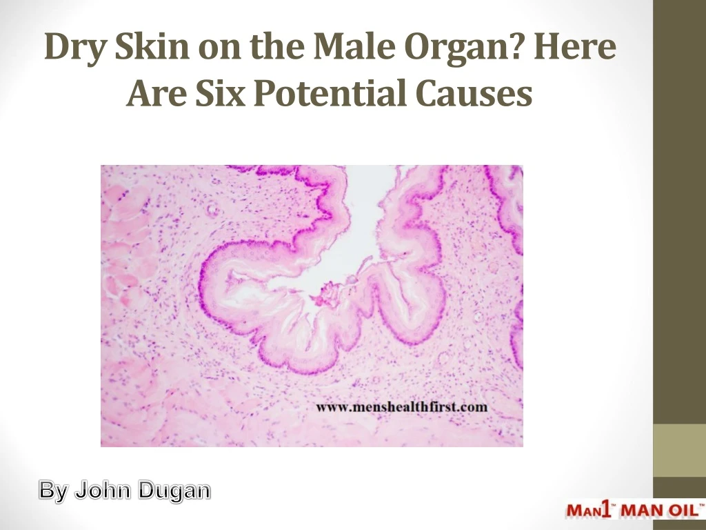 dry skin on the male organ here are six potential causes