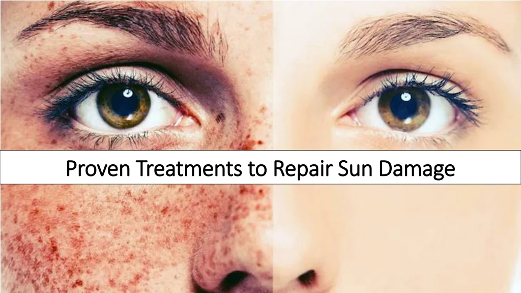 proven treatments to repair sun damage