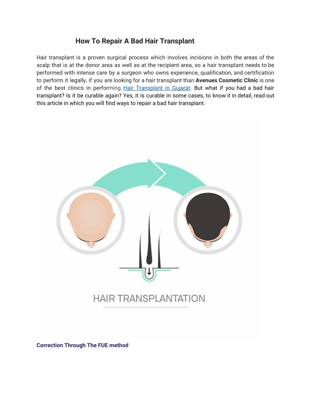 how to repair a bad hair transplant hair