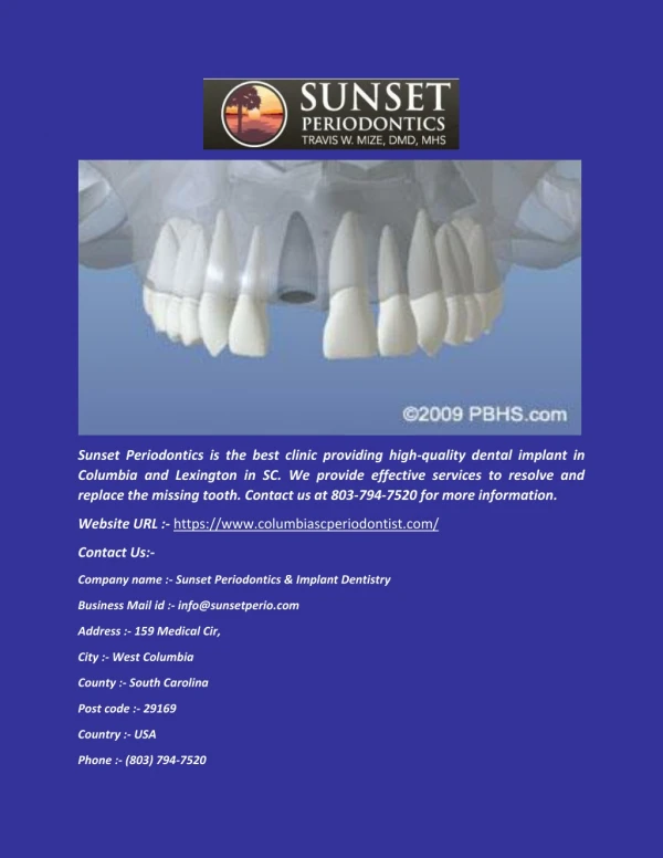 Dental Implant in Columbia, Lexington, SC - columbiascperiodontist.com