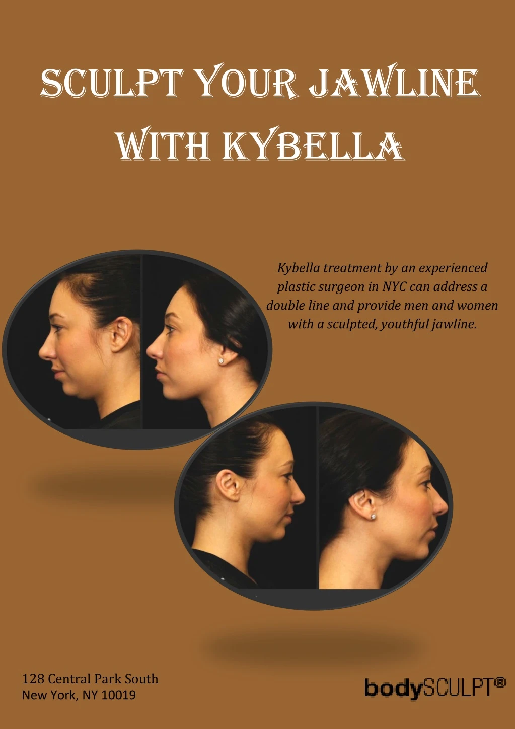 sculpt your jawline with kybella