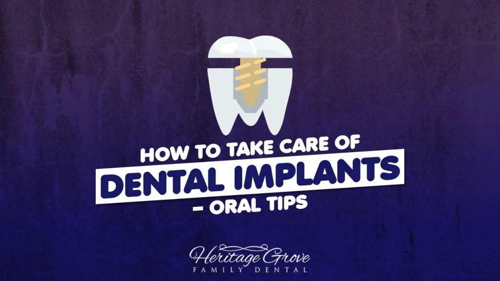 how to take care of dental implants oral tips