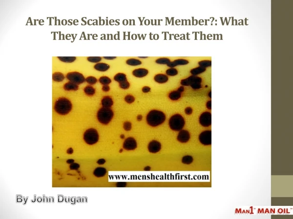 Are Those Scabies on Your Member?: What They Are and How to Treat Them