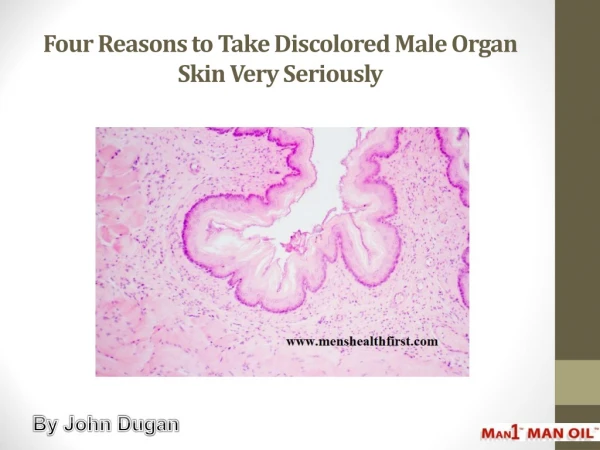 Four Reasons to Take Discolored Male Organ Skin Very Seriously