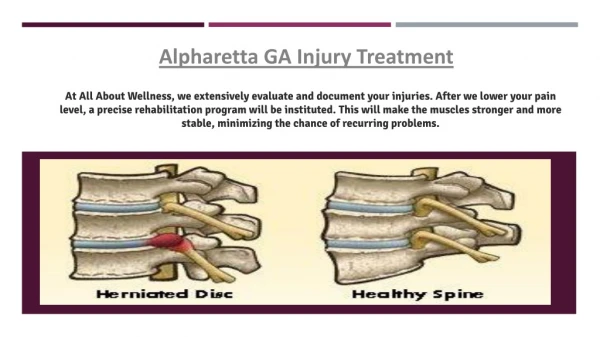 Alpharetta GA Injury Treatment