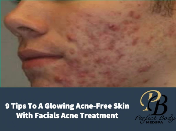 9 Tips To A Glowing Acne-Free Skin With Facials Acne Treatment