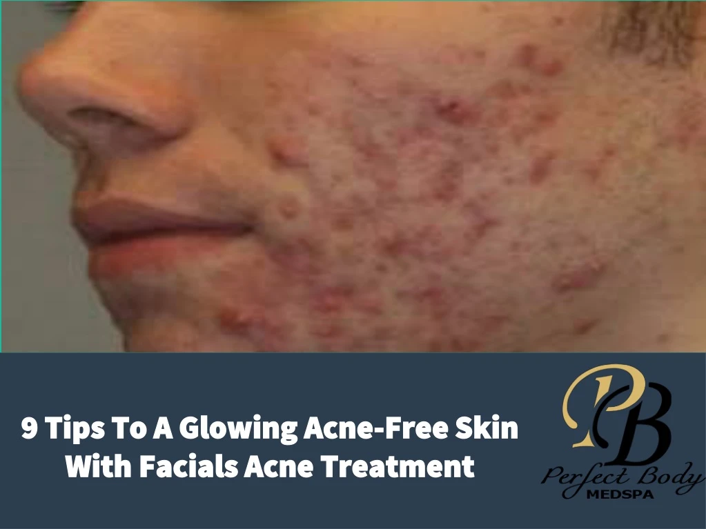 9 tips to a glowing acne free skin with facials
