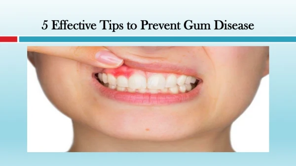 Effective Tips to Prevent Gum Disease
