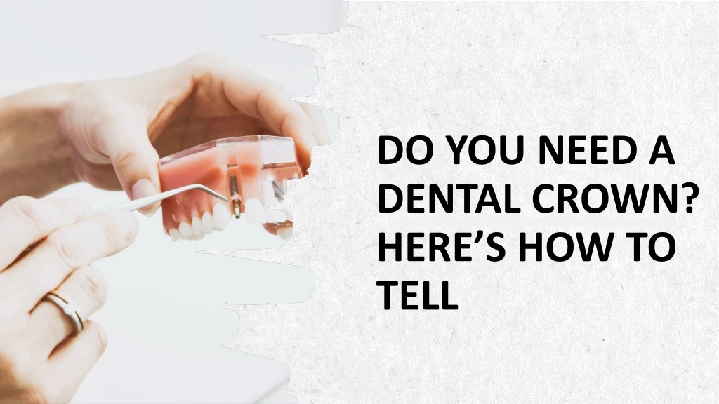 do you need a dental crown here s how to tell