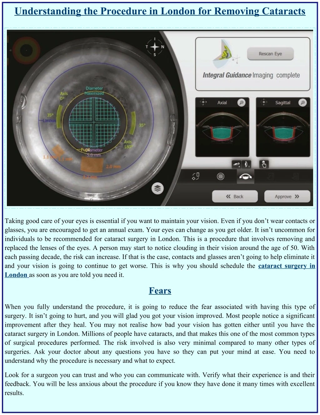 understanding the procedure in london