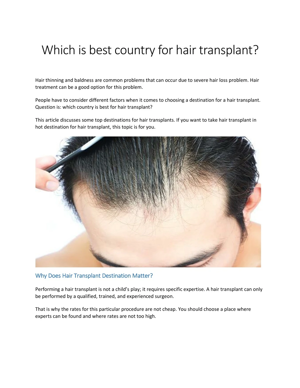 which is best country for hair transplant